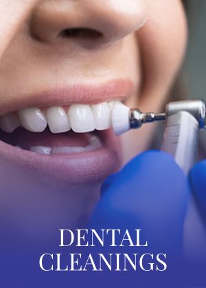Dental Cleanings Serving in Bay Area, San Jose, CA Dental Cleanings Serving in Bay Area, San Jose, CA
